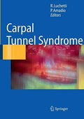 Carpal Tunnel Syndrome Book B504984